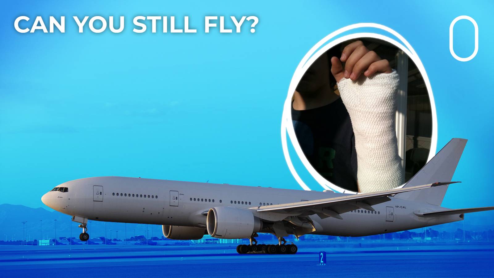 Flying With A Plaster Cast: Everything You Need To Know