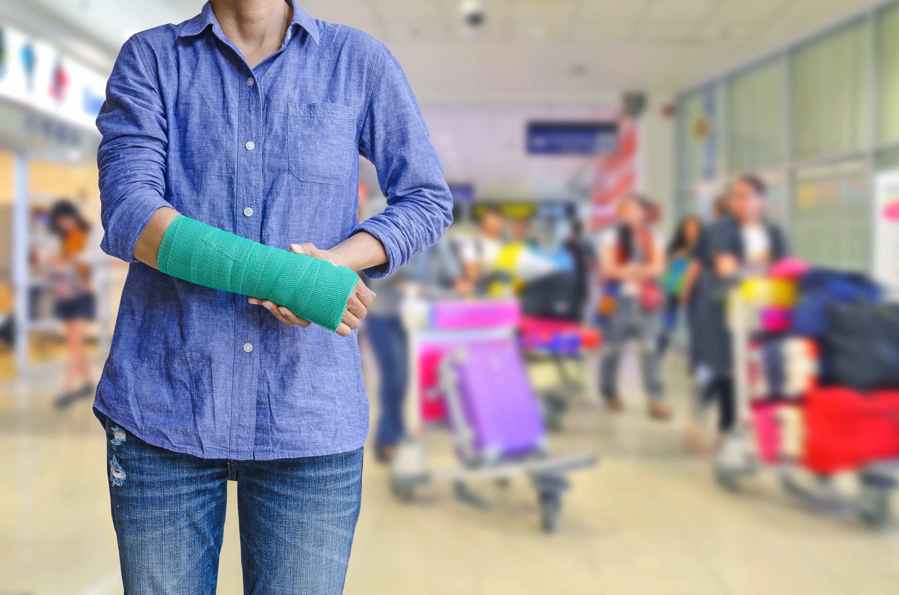 Flying With A Plaster Cast: Everything You Need To Know